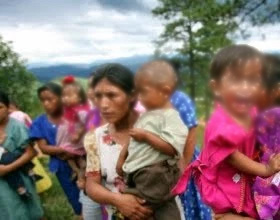 niños desnutridos