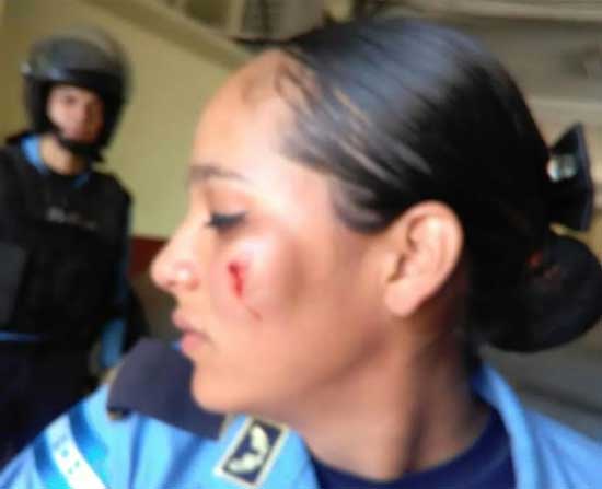 policia herida
