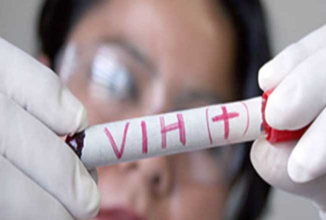 Los casos de VIH bajan en Australia pero aumentan entre heterosexuales