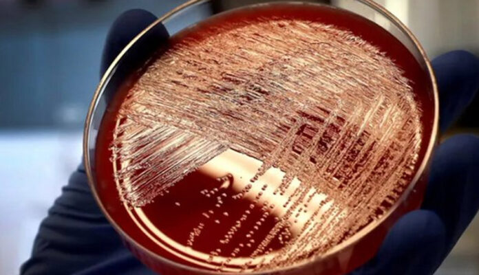 OMS riesgo de enfermedad invasiva por estreptococo A para población es
